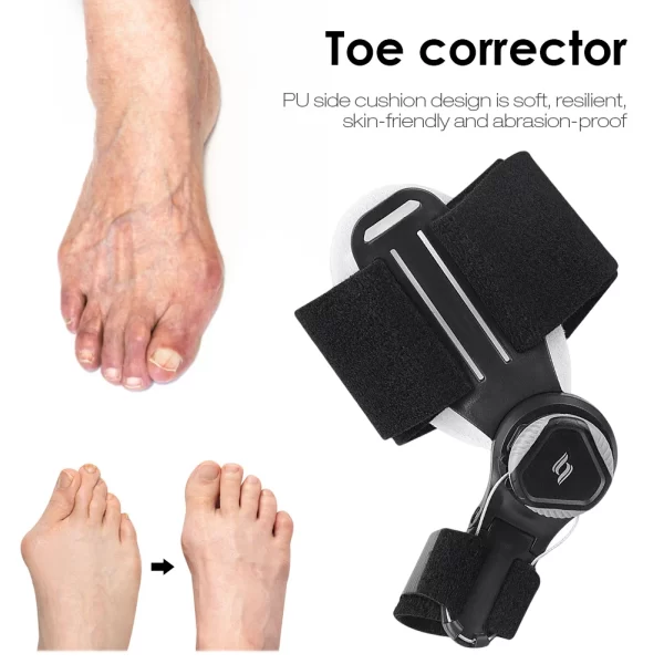 Corrector Juanete TU regulable - Imagen 5